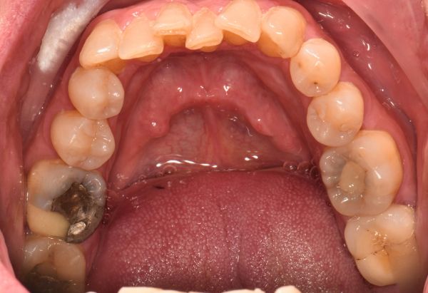 Before - Peacock Dental Spa