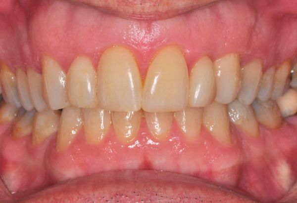 After -Peacock Dental Spa