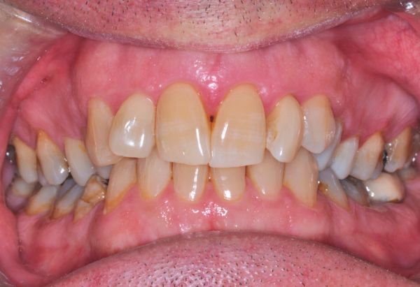 Before - Peacock Dental Spa