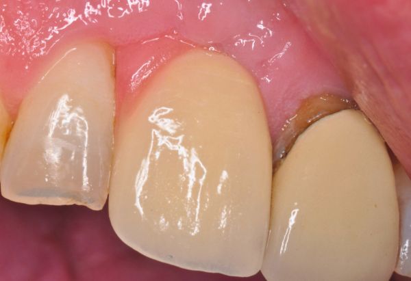 After -Peacock Dental Spa