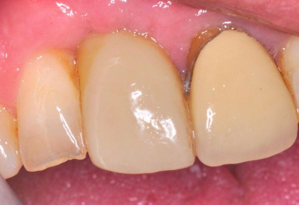 Before - Peacock Dental Spa