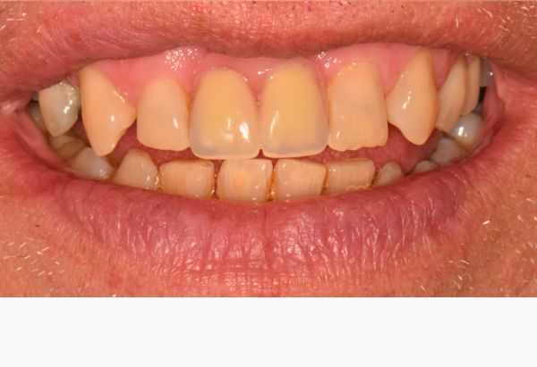 After -Peacock Dental Spa