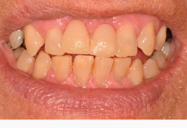 Before - Peacock Dental Spa