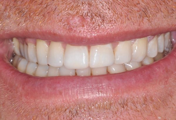 After -Peacock Dental Spa