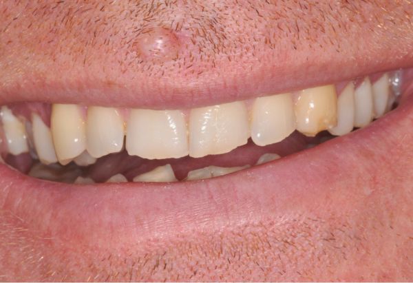 Before - Peacock Dental Spa