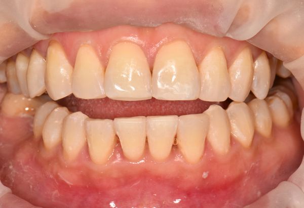 After -Peacock Dental Spa