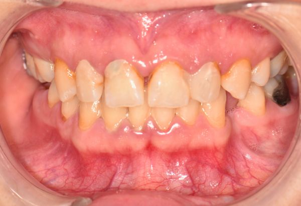 Before - Peacock Dental Spa