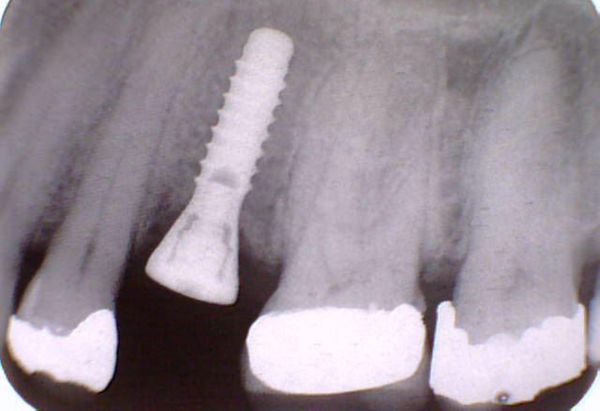 After -Peacock Dental Spa