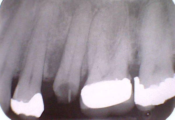 Before - Peacock Dental Spa