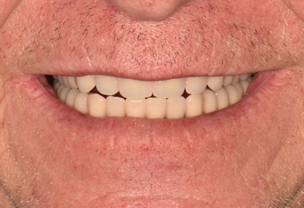 After -Peacock Dental Spa