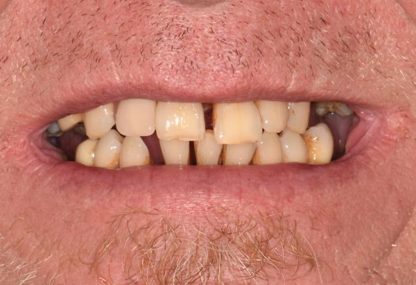 Before - Peacock Dental Spa