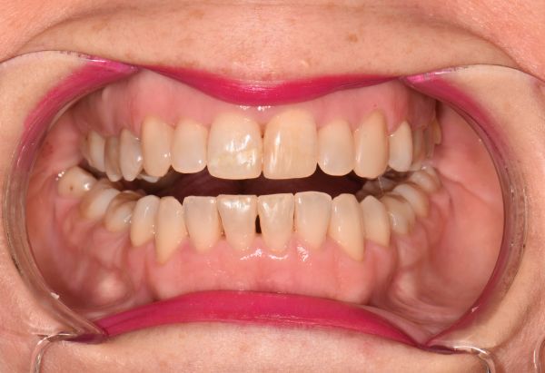 After -Peacock Dental Spa