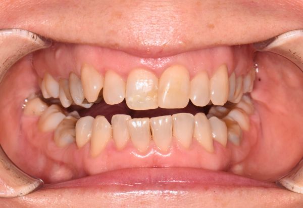 Before - Peacock Dental Spa