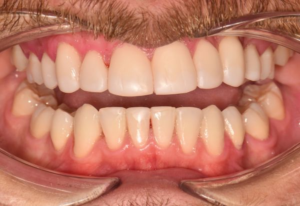 After - Peacock Dental Spa