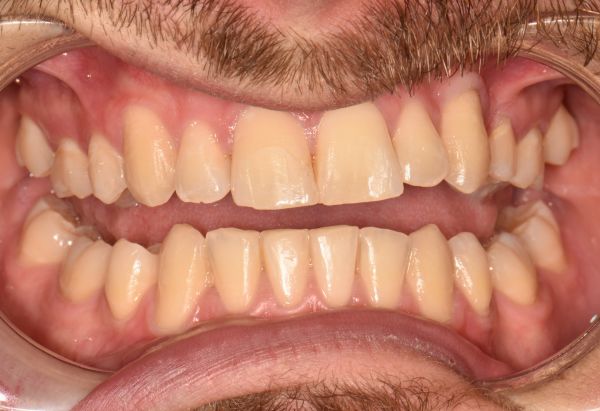 Before - Peacock Dental Spa