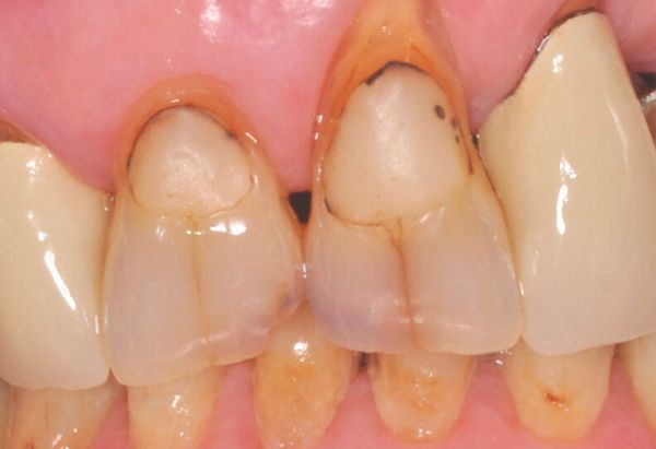 Before - Peacock Dental Spa