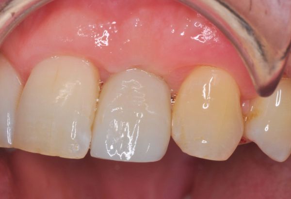 After -Peacock Dental Spa