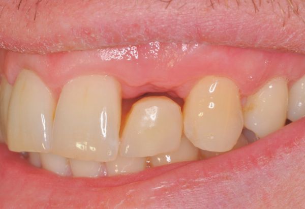 Before - Peacock Dental Spa