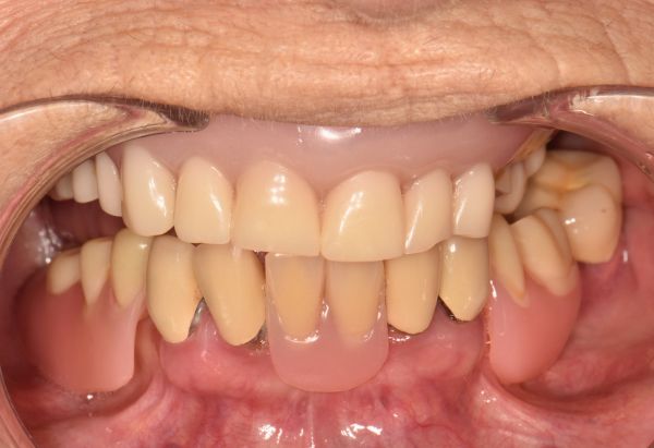 Before - Peacock Dental Spa