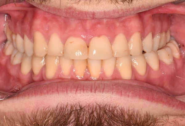 Before - Peacock Dental Spa