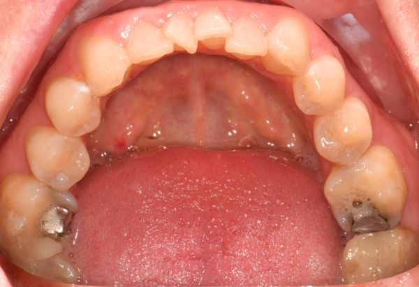 Before - Peacock Dental Spa