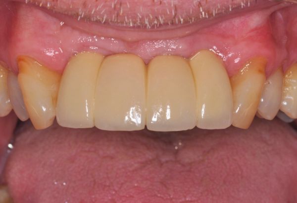 After -Peacock Dental Spa