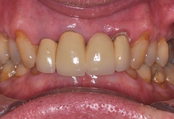 Before - Peacock Dental Spa