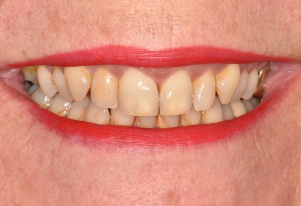 Before - Peacock Dental Spa