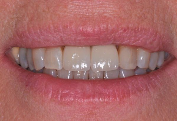 After -Peacock Dental Spa