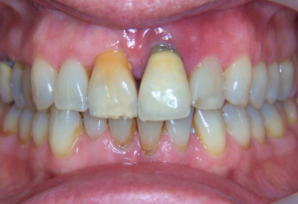 Before - Peacock Dental Spa