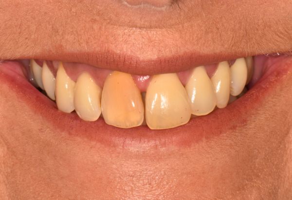 Before - Peacock Dental Spa