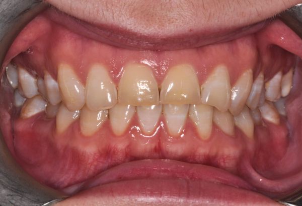 Before - Peacock Dental Spa