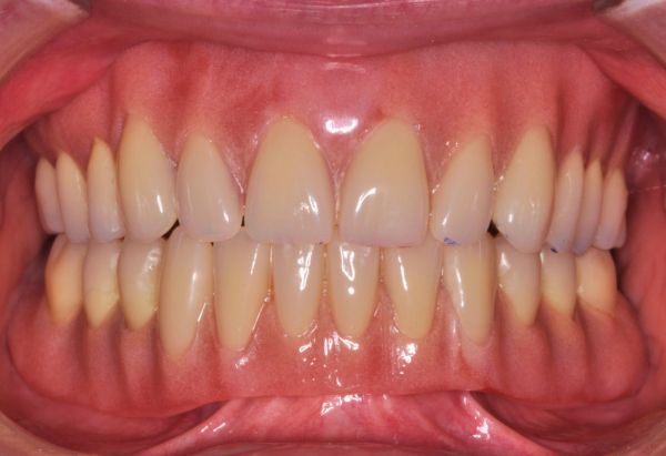 After -Peacock Dental Spa