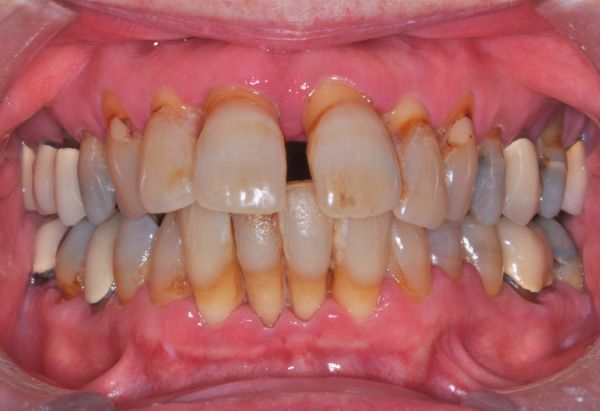 Before - Peacock Dental Spa