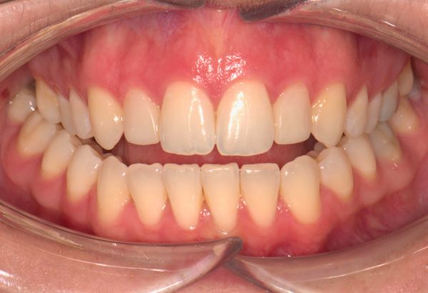 After -Peacock Dental Spa