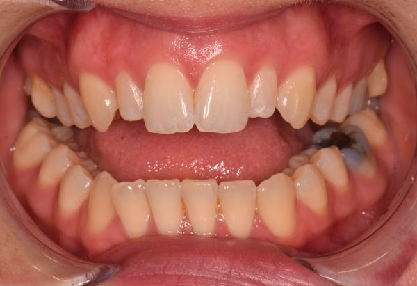 Before - Peacock Dental Spa