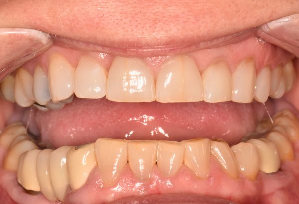 Before - Peacock Dental Spa