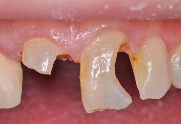 Before - Peacock Dental Spa