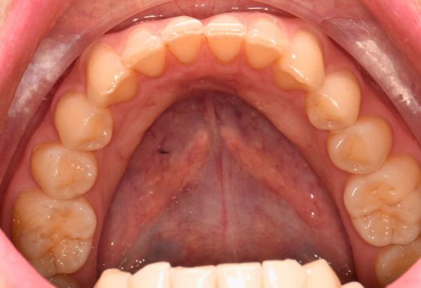 Before - Peacock Dental Spa