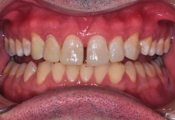 After -Peacock Dental Spa