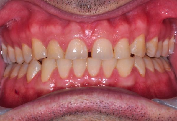 Before - Peacock Dental Spa