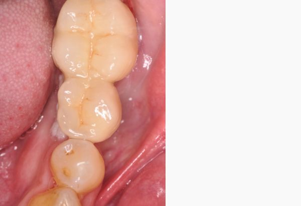 After -Peacock Dental Spa