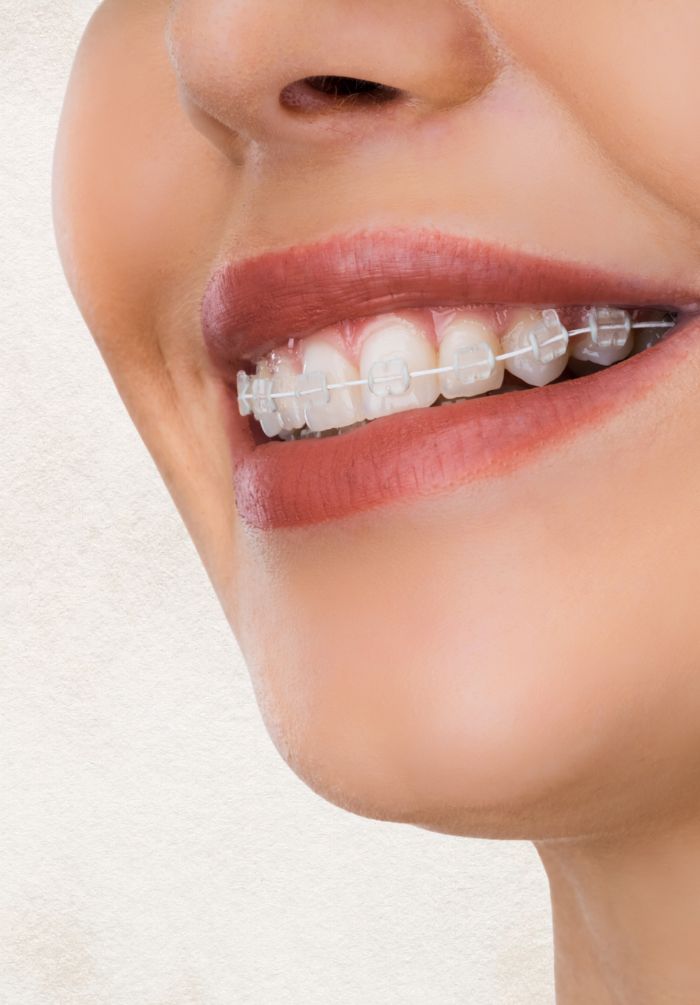 Treatment -  Peacock Dental Practice