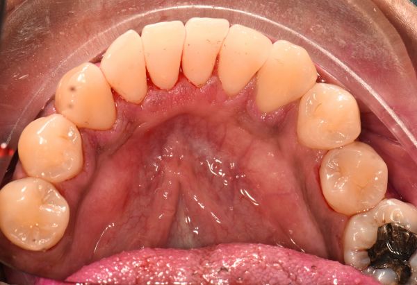 After -Peacock Dental Spa