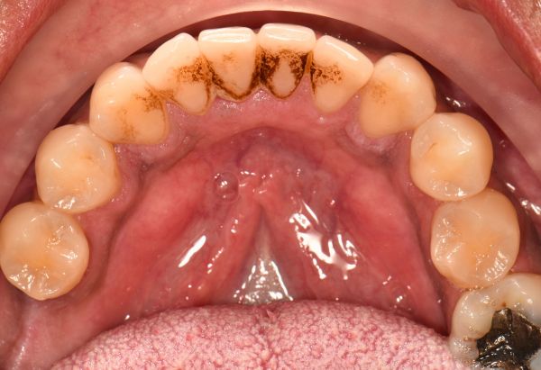 Before - Peacock Dental Spa