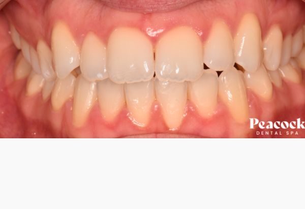 After -Peacock Dental Spa