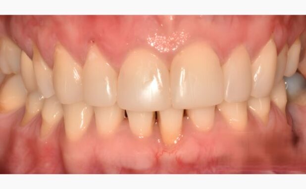 After -Peacock Dental Spa