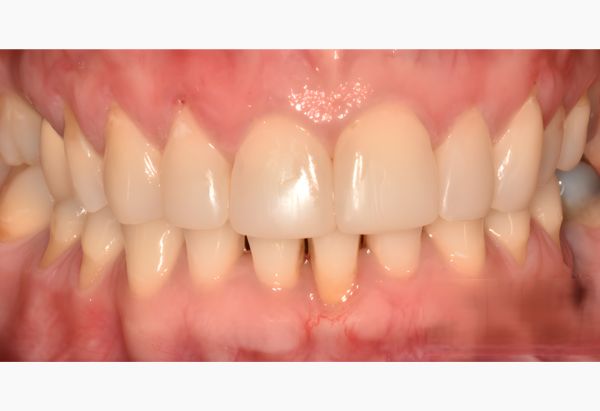 After -Peacock Dental Spa