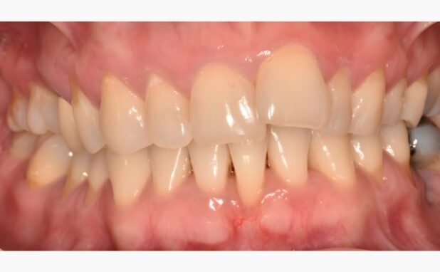 Before - Peacock Dental Spa