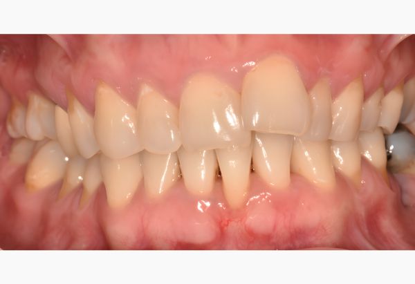 Before - Peacock Dental Spa